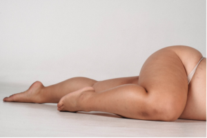 excess weight and obesity